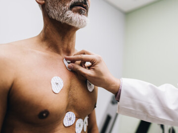 EKG